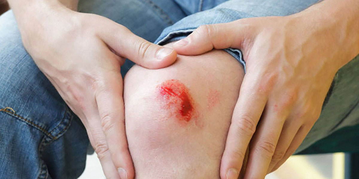 زخم چیست زخم چیست